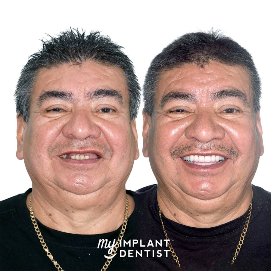 Photo of My Implant Dentist South Perth